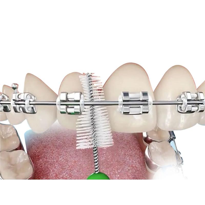 Inter Dental prush