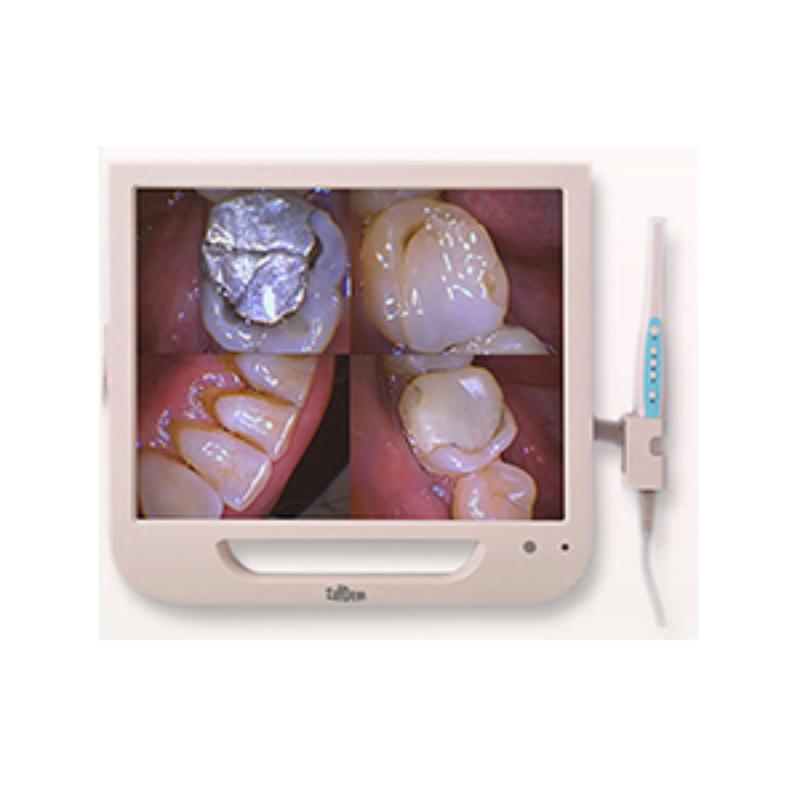 Zafdent Intraoral Camera
